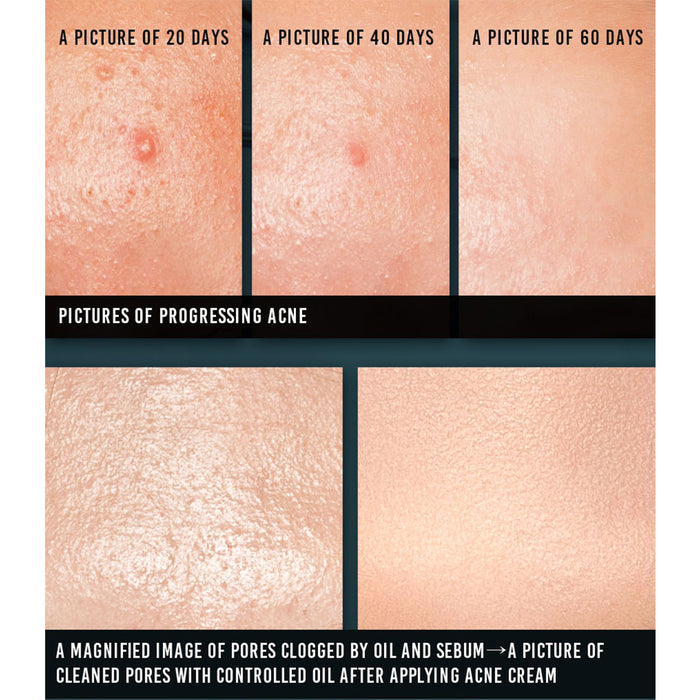 Pyunkang Yul Acne Cream Nudie Glow Korean Skin Care Australia