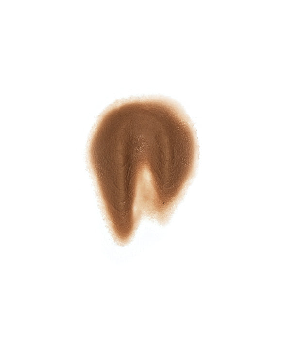 Female Neck Waddle 1