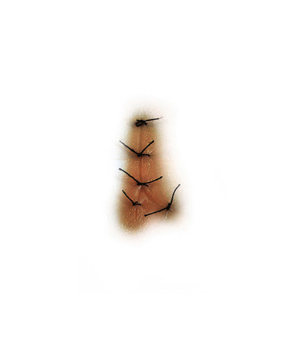 Y Shaped Sutured Wound (Medium)
