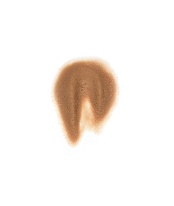 Female Neck Waddle 1