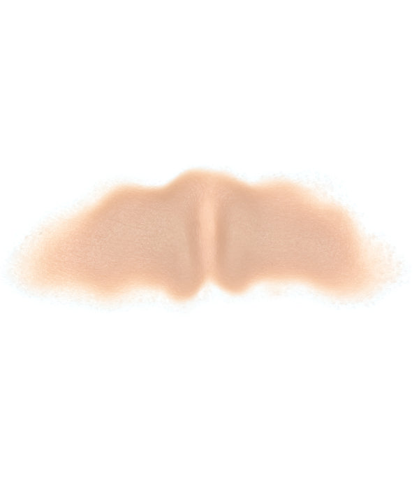 Female Neck Waddle 5