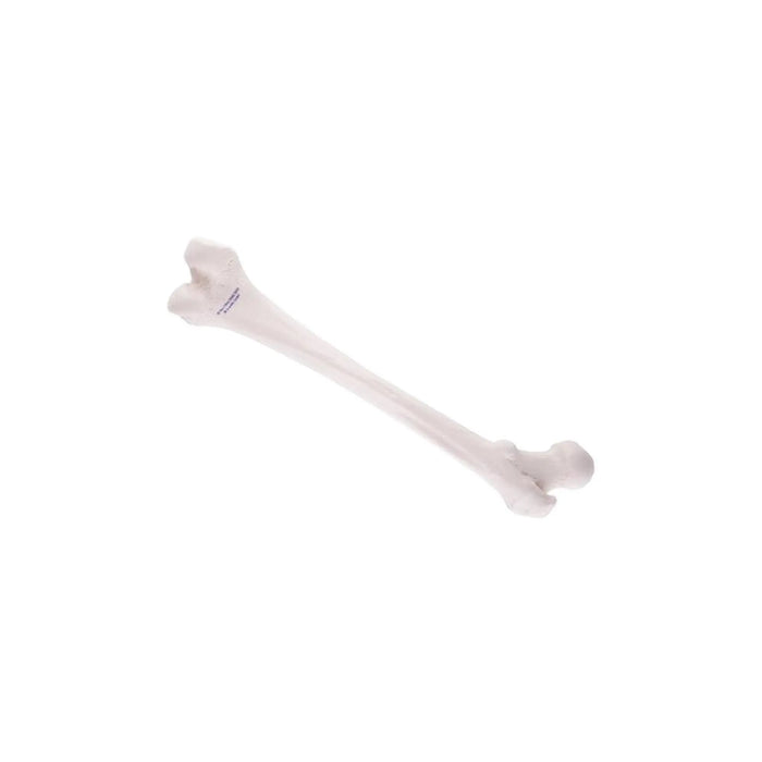 Femur - Anatomy and pathology - My Podiatry
