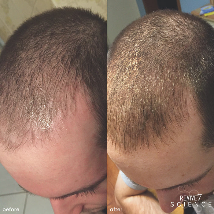 Hair Oil