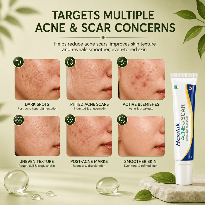 Hexilak Acne + Scar Serum / Gel - Cosmosentials