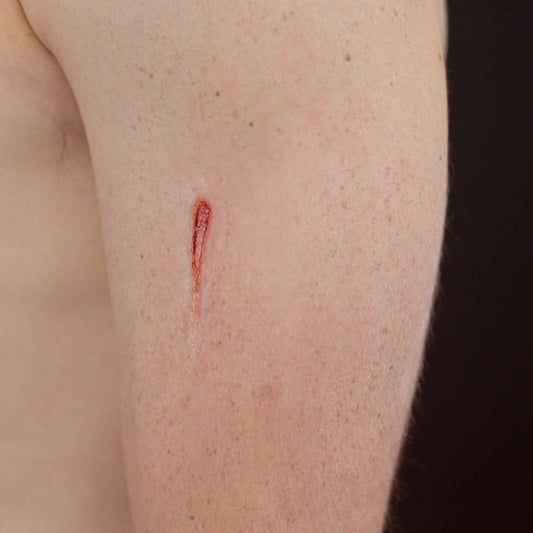 Nail Gouged Skin (Small)