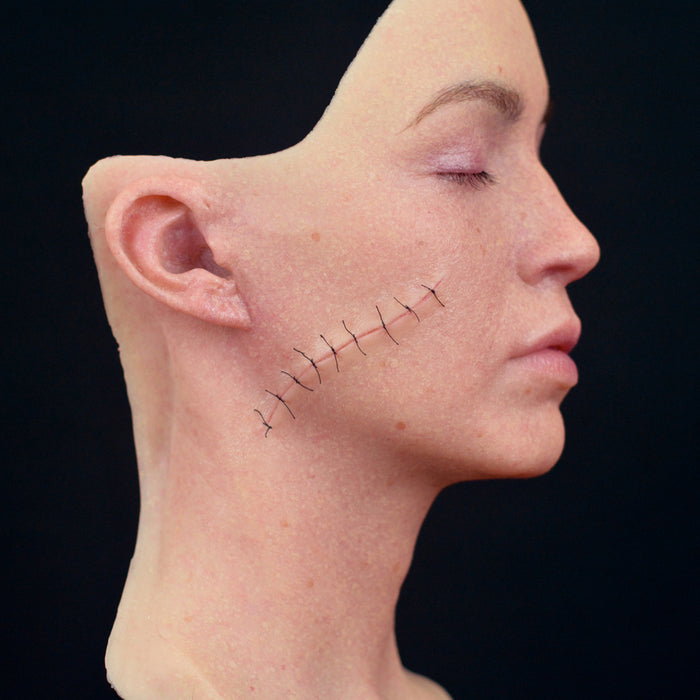 Sutured Wound (Large)