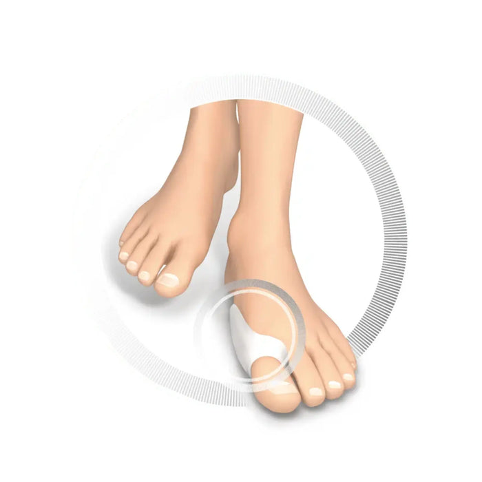 Toe protection - Protective gel support - Ruck Ruck
