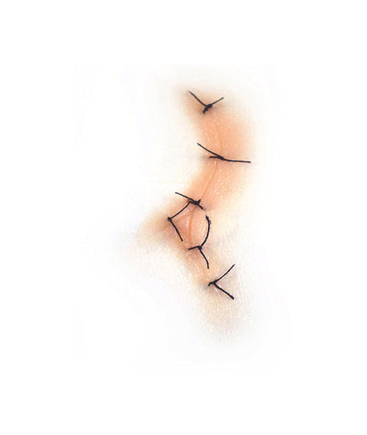 Y Shaped Sutured Wound (Large)
